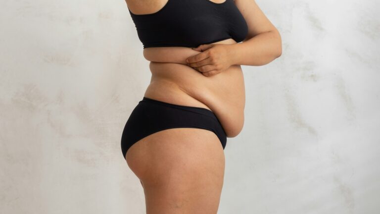 How to Prevent Loose Skin During Weight Loss